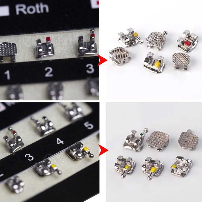 VEZE حاملات الأسنان، حاملات لتقويم الأسنان، 5 مجموعات 100 قطعة نموذج أسنان تقويم الأسنان حاملات MBT مصغرة MBT 022 فتحة قابلة للربط، 345 خطاف. - Image 5